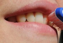 Abcesul dentar